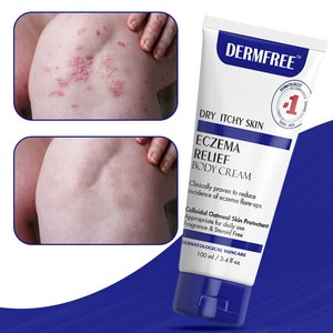 DERMFREE 건선연고 두드러기 피부 가려움 크림, 1개, 100ml