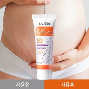 SADOER스트레치 마크 크림-미국 FDA 인증 획득 주로 튼살을 수리합니다 뚱뚱한 선 엄마들이 완벽한 피부를 가지도록 해주세요, 1개, 40g