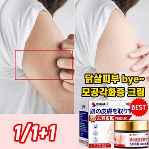 [일본개발]1/1+1 모공 각화증 크림 닭살 피부 제거 연고 뱀살 연화 바디로션 몸 팔 습제 수딩젤, 1개, 30g