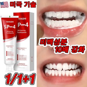 미국 SP4 1+1/2+2 고불소 미백 치약 프로바이오틱 치약 화이트닝 잇몸붓기 염증 예방 구취케어 치약, 1개, 120g