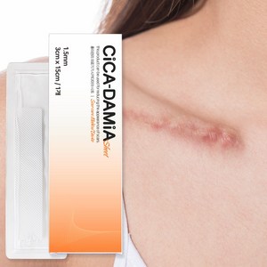 시카다미아 시트 흉터 밴드, 1개, 1개입