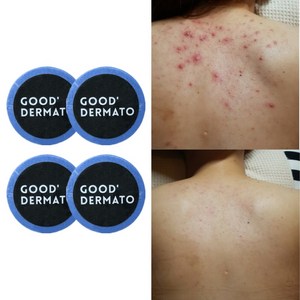 굿더마토 Mint for 데코르테 바디바 115g (등가슴 성난피지 바디바로 싹! 문제성 바디각질 딥클렌징~ 천연수제비누 바디워시), 4개