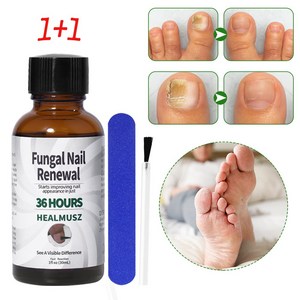 [당일배송] HEALMUSZ 손톱 발톱무좀 발무좀 에센스 손톱 리페어 에센스 항진균 감염, 2개, 30ml