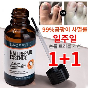 [국내 배송] 리페어 에센스 토탈 발톱무좀 손발톱 케어 전용 쓱싹크림, 2개, 30g