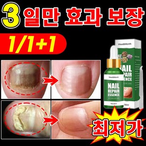 [국내당일출고] 손톱 발톱 앰플 손발톱 영양제 네일 케어 문제성발톱 진균 발톱강화 관리 효과 짱, 2개, 30ml