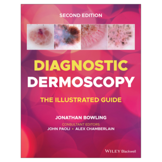 Diagnostic Dermoscopy : The Illustrated Guide 2nd Edition