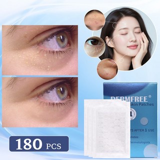 비립종 여드름 패치 하나로 끝? 내 피부 고민 솔직 후기