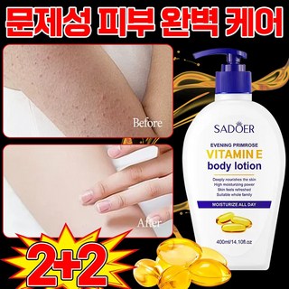 [즉각보습] 고보습 바디로션 모공각화증 바디로션 문제성피부 여성 남자 바디크림, 4개, 400ml