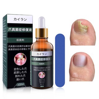 손톱 발톱 진균 발톱강화 손발톱 문제성 발톱 토탈 솔루션 앰플, 1개, 50ml