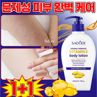 [즉각보습] 고보습 바디로션 모공각화증 바디로션 문제성피부 여성 남자 바디크림, 2개, 400ml