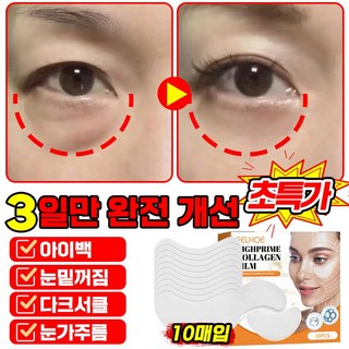 [빠른효과] 미국개발 10+10/20+20 콜라겐 아이패치 아이백 리프트팩 눈밑꺼짐 다크서클 제거 아이팩 눈가 주름 팔자주름 개선 아이케어 포장증정, 1개, 10개입