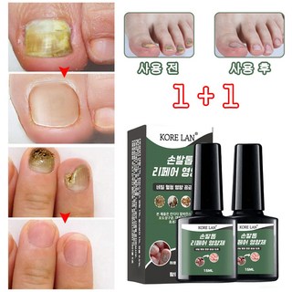 (국내산/당일발송) EELHOE 네일 발톱 발톱무좀 영양제 관리 앰플 내성 곰팡이 살균 2개 20ml 상품 이미지