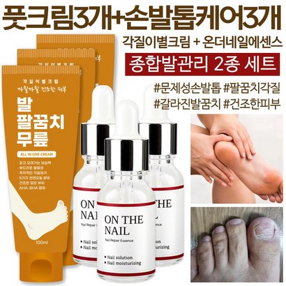 각질이별크림  즉각적인 보습 각질제거 갈리진 뒷꿈치 팔꿈치 팔 다리 무릎 건조한 모든피부 발크림 풋크림 보습크림 고농축 풋케어 극건성 고보습 바디