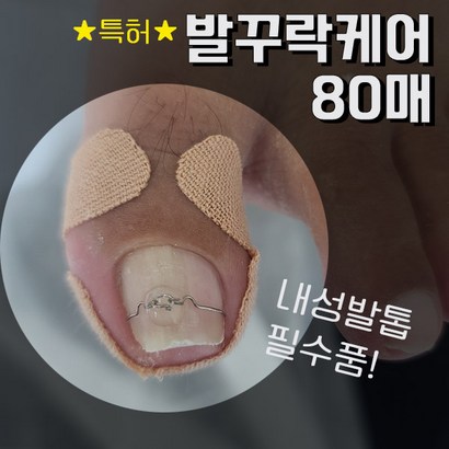 무좀 내성발톱 테이프/무혈무수술 무통증 케어/ 그동안고생하셨어요! 이제 아픈통증은그만! 예쁜발톱을 길러주세여- 발꾸락케어 80매 리뷰후기