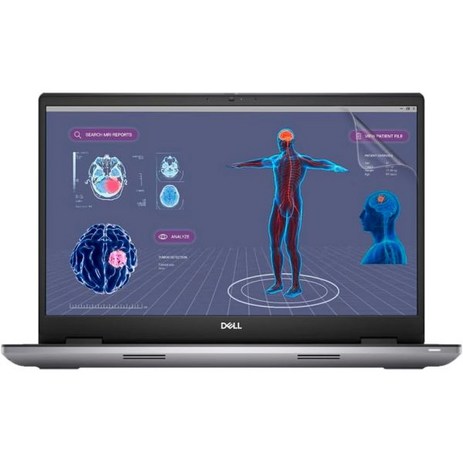 매트 눈부심 방지 스크린 프로텍터 for Dell Precision 17.3인치 7780 워크스테이션 2 PACK, 단일-추천-상품