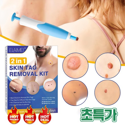 nekvnro 편평제거 - [빠른배송] 2in1 피부 태그 제거 도구 물 사마귀 없애는법 얼굴 피부케어 포장증정, 그린, 1개