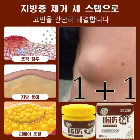 1+1 다기능지방종제거크림 허브 에센스 지방종 크림 덩어리크림 미용크림, 20g*6