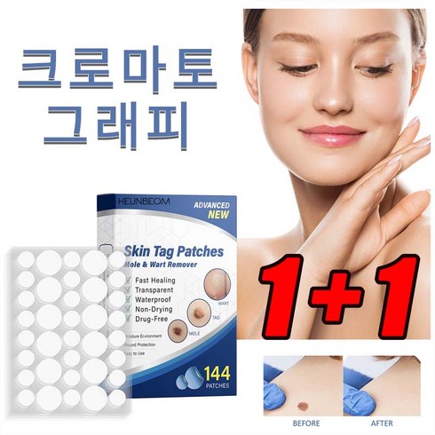 1+1 패치 비립종 제거 편평사마귀제거, 1개, 180개입