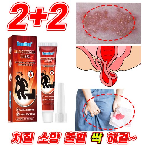 [빠른배송] 1+1+1 항문 치질 연고 사타구니 가려움증 소양증 통증 출혈 치료 사면발이 항문튀어나옴 제거 전용 크림, 4개