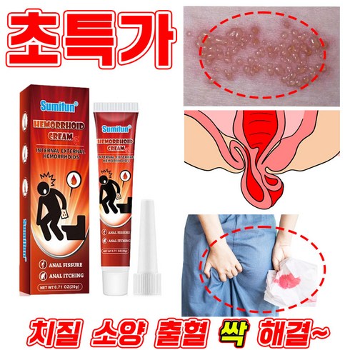 [빠른배송] 1+1+1 항문 치질 연고 사타구니 가려움증 소양증 통증 출혈 치료 사면발이 항문튀어나옴 제거 전용 크림, 1개