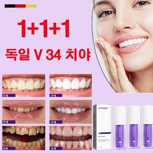 hismile - 독일 1+1+1 미백치약 치아미백제 V34 치아토닝 에센스 치석 제거치약 입냄새제거, 3개, 30ml