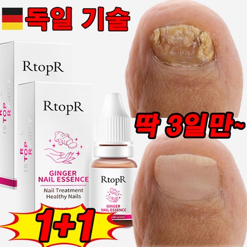 강아지 발톱 깨짐 - [딱 3일만] 1/1+1 손톱 발톱 영양제 조갑 강화 에센스 손발톱 케어/효과보장!!!, 2개, 10ml