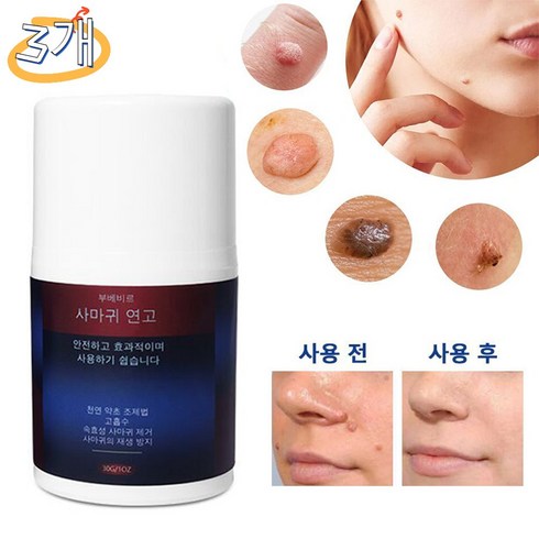 연고 피부 제거제 깨끗해짐 피부 복원 피부 문제 대응, 30g, 3개