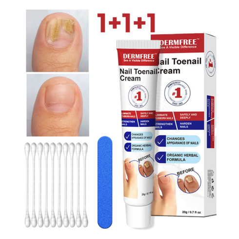 dermfree 리페어 크림 - DERMFREE 발톱 무좀 손발톱 케어 크림 풋 리페어 크림, 21g, 3개