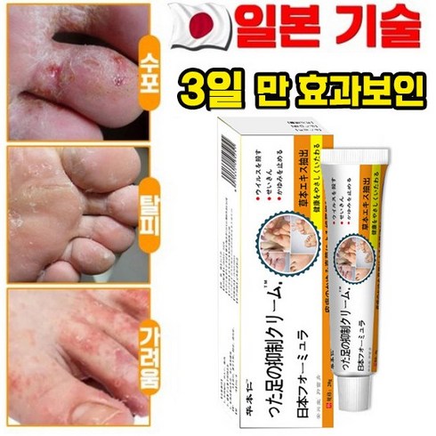 nekvnro 바디케어세럼 - [국내배송] 일본 발 연고 발냄새 제거 발바닥 발가락 가려움 완화 연고 포장증정, 1개, 20g, 1개입