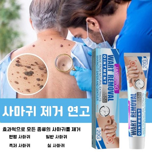  쥐젖제거크림 탑7 추천 가격 정보