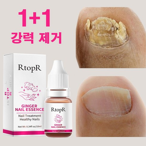 땅고리얼큐어 - 유오노미 독일 1+1 손발톱 발톱 관리 네일, 2개, 10ml