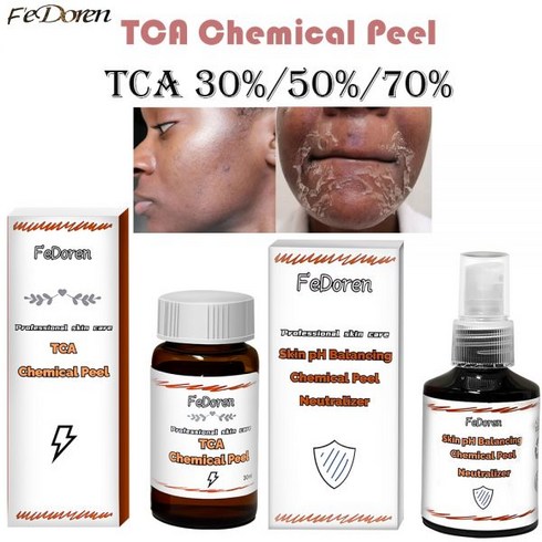 멕시코시타이탄프로 - TCA 화학 필 70% 필링 산 중성화제 세트 슈퍼 포스 색소 침착 흉터 트리트먼트 세럼 30ml, [01] TCA, [04] Neutralizer 50ml, 02 Neutralizer 50ml