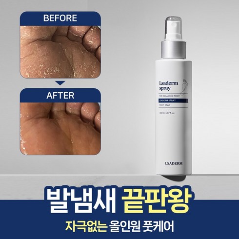 르사덤 스프레이 뿌리는 올인원 발바닥 발가락 간지러움 발냄새 곰팡이균제거제 150ml, 1개, 1개