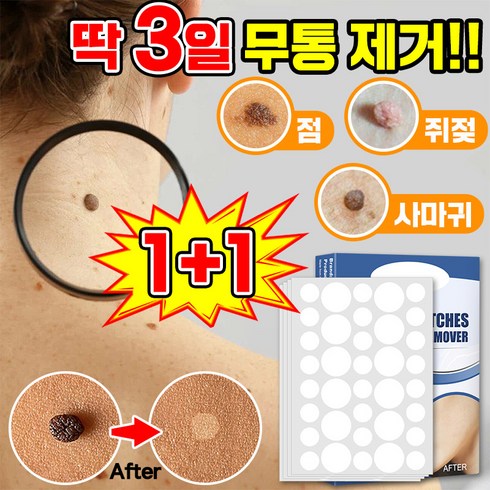 사마귀제거 - [빠른배송] 피부 제거 패치 얼굴 바디 피부 치료 라벨 스텔스 포장증정, 143매입, 2개