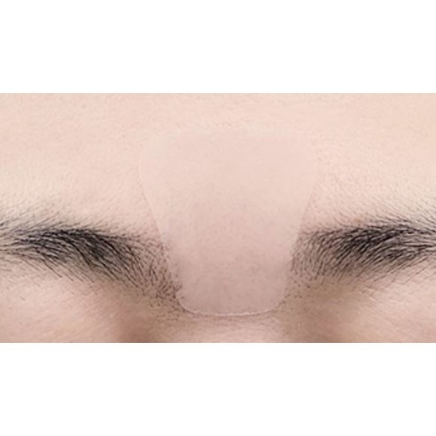 비타할로 미간 주름 리페어 링클 패치(인체적용 테스트 완료), 55개입, 1개