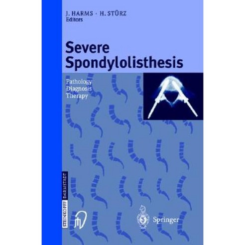 Severe Spondylolisthesis: Pathology - Diagnosis - Therapy Hardcover, Steinkopff-Verlag Darmstadt