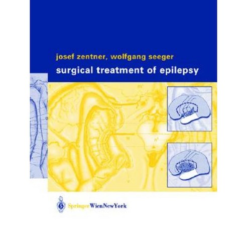 Surgical Treatment of Epilepsy Hardcover, Springer - 가격 변동 추적 그래프 - 역대가