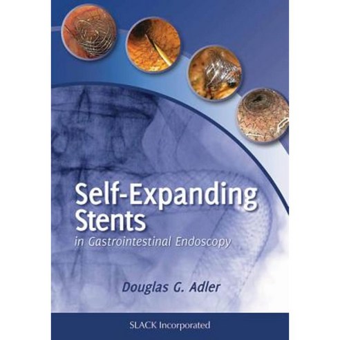 Self-Expanding Stents in Gastrointestinal Endoscopy Hardcover, Slack