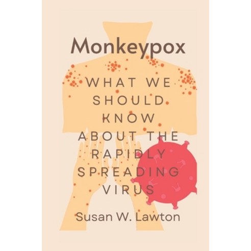 (영문도서) Monkeypox: What we should know about the rapidly spreading virus Paperback, Independently Published, English, 9798844424038