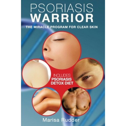 (영문도서) Psoriasis Warrior: The Miracle Program for Clear skin Paperback, Randall Caruso, English, 9780999180495