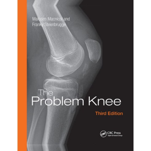 (영문도서) The Problem Knee Paperback, CRC Press, English, 9781138372467