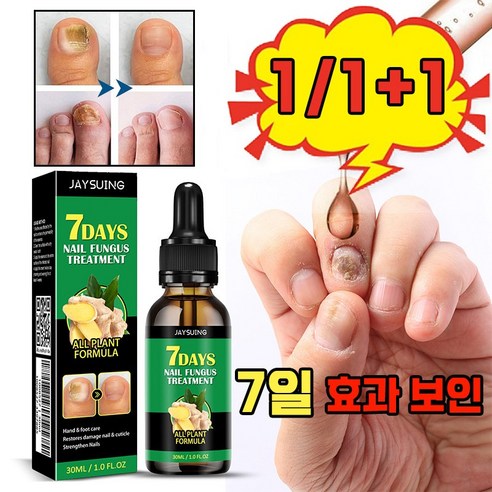 [국내배송] 발톱 약 치료제 손톱 영양제 강화제 진균 리페어 에선스 케어 앰플 포장증정, 1개, 30ml