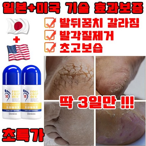 [일본 최신 기술] 1+1/2+2 초고보습 풋크림 발크림 각질 제거 크림 풋 스틱 발뒤꿈치 갈라짐 연화 발관리 케어 안심배송 증정, 50ml, 1개