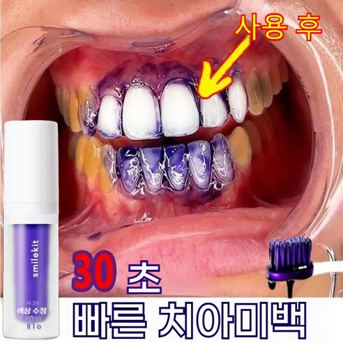 (한국셀러/본토출하) v34 셀프치아미백 구강 위생 클렌징 /환불 보장 치아 추천 화이트닝 치약, 30ml × 1개, 1개, 30ml