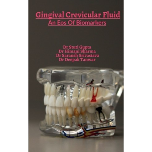 (영문도서) Gingival Crevicular Fluid Paperback, Notion Press, English, 9781649194602