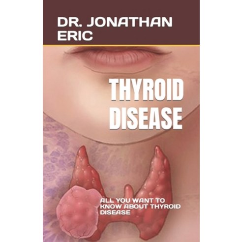 (영문도서) Thyroid Disease: All You Want to Know about Thyroid Disease Paperback, Independently Published, English, 9798374343526