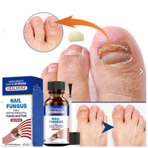 HEALMUSZ 발톱무좀 발무좀연고 리페어 에센스, 30ml, 2개