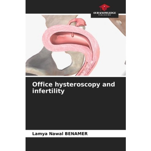 (영문도서) Office hysteroscopy and infertility Paperback, Our Knowledge Publishing, English, 9786207560974