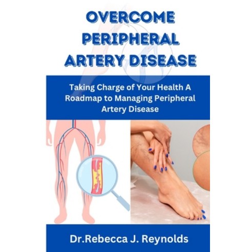 (영문도서) Overcome Peripheral Artery Disease: Taking Charge of Your Health A Roadmap to Managing Periph... Paperback, Independently Published, English, 9798862738605