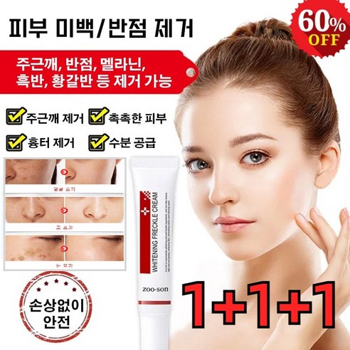 1+1+1 반점 제거 연고 주근깨 케어 화이트닝 스팟 크림 제거 주근깨/반점/멜라닌/흑반, 20g*(1+1+1)